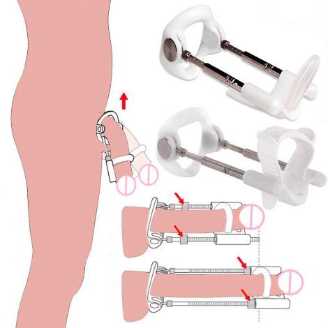 Sistema para alargar el pene